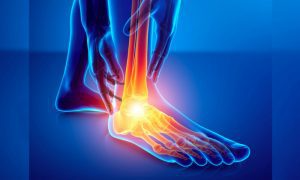 Top 3 Causes for Foot and Ankle Pain
