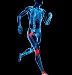Top 5 Causes of Running Injuries